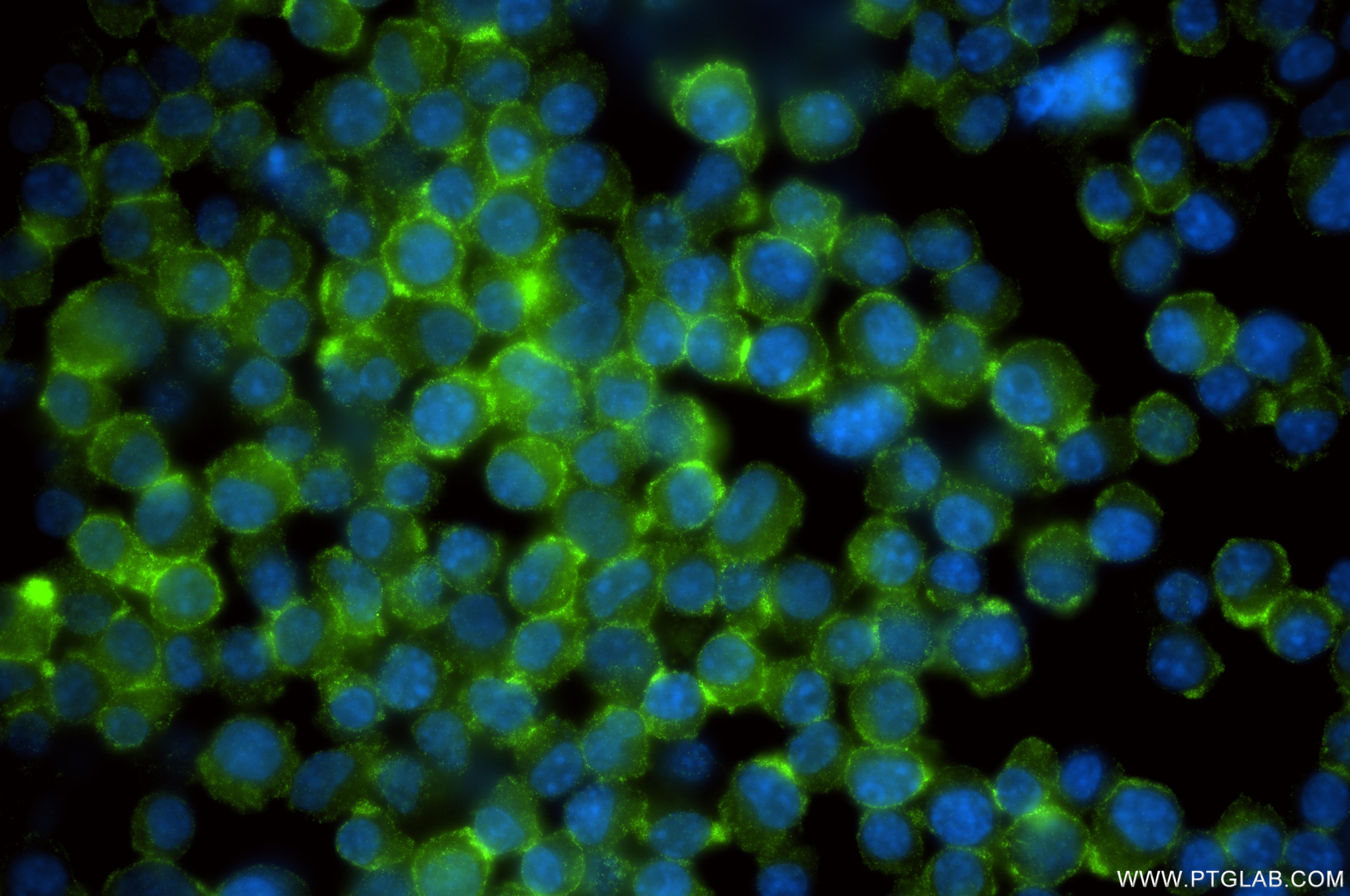 Immunofluorescence (IF) / fluorescent staining of U266 cells using IFNAR2 Recombinant monoclonal antibody (83068-5-RR)