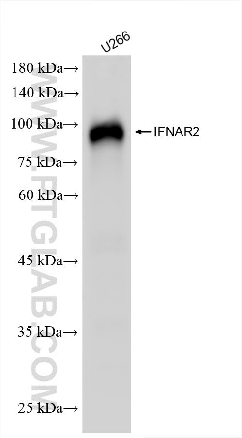 Western Blot (WB) analysis of U266 cells using IFNAR2 Recombinant antibody (83068-5-RR)
