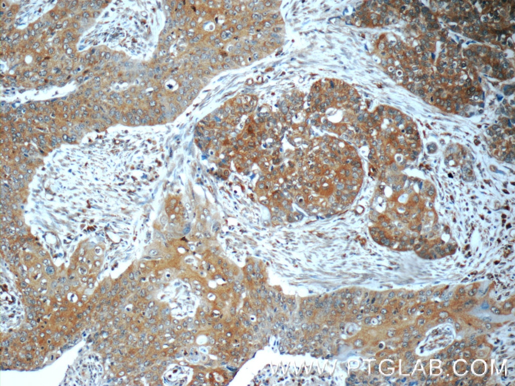 IFN Gamma Polyclonal antibody