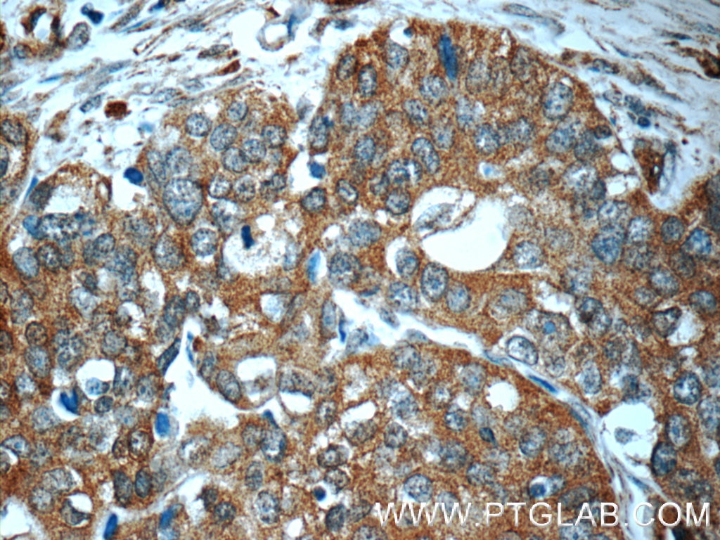 IFN Gamma Polyclonal antibody