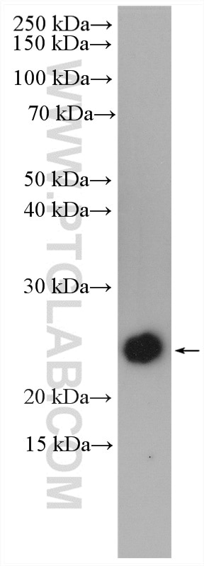 Western Blot (WB) analysis of Recombinant protein using IFN Gamma Polyclonal antibody (15365-1-AP)