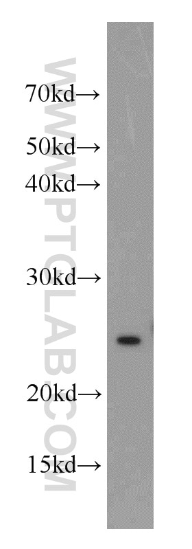 IFN Gamma Polyclonal antibody