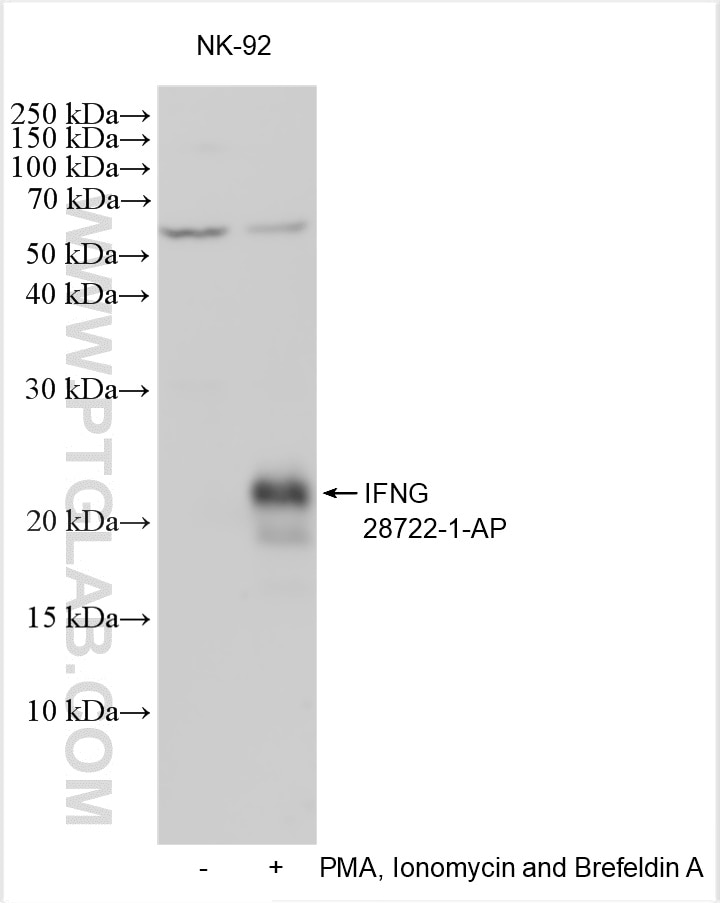 Western Blot (WB) analysis of various lysates using IFN gamma Polyclonal antibody (28722-1-AP)