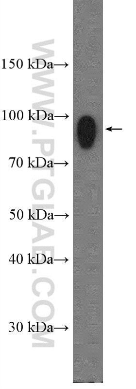 Western Blot (WB) analysis of HEK-293 cells using IFNGR1 Polyclonal antibody (10808-1-AP)