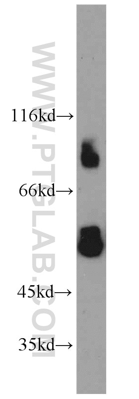Western Blot (WB) analysis of HepG2 cells using IFNGR1 Polyclonal antibody (10808-1-AP)