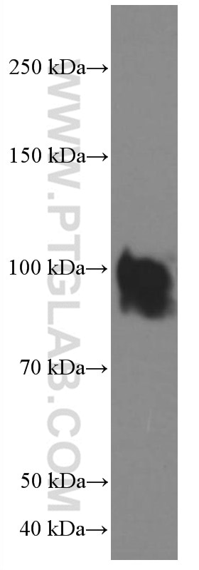 Western Blot (WB) analysis of Jurkat cells using IFNGR1 Monoclonal antibody (66704-1-Ig)