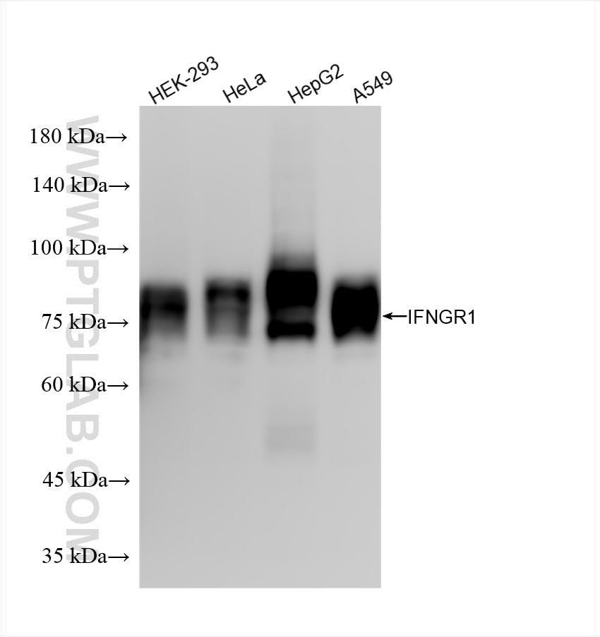 IFNGR1/CD119