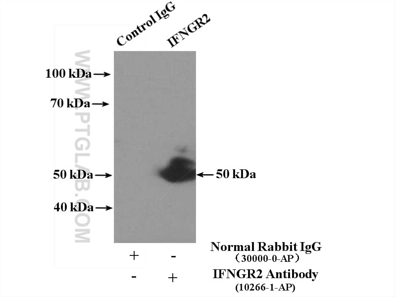 Immunoprecipitation (IP) experiment of A549 cells using IFNGR2 Polyclonal antibody (10266-1-AP)