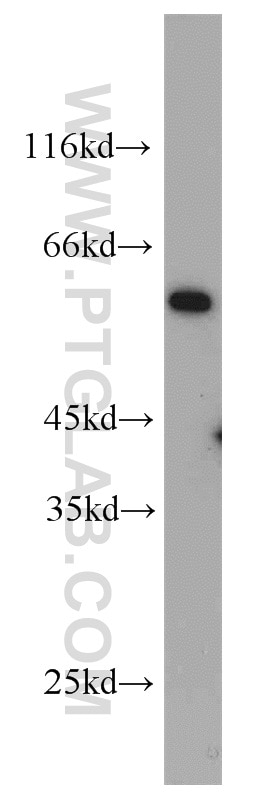 Western Blot (WB) analysis of HeLa cells using IFNGR2 Polyclonal antibody (10266-1-AP)
