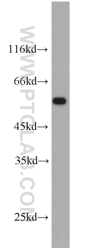 Western Blot (WB) analysis of A549 cells using IFNGR2 Polyclonal antibody (10266-1-AP)