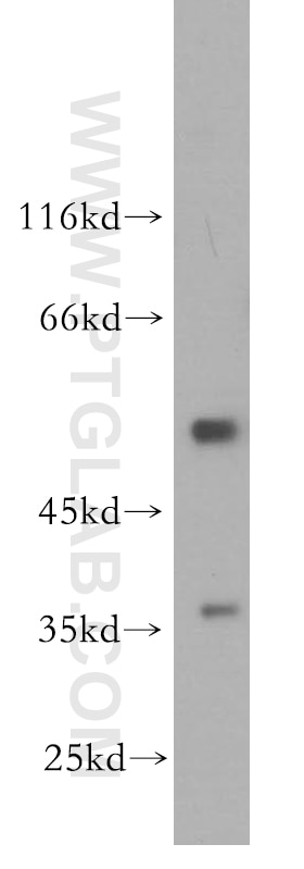 Western Blot (WB) analysis of HeLa cells using IFRD1 Polyclonal antibody (12939-1-AP)