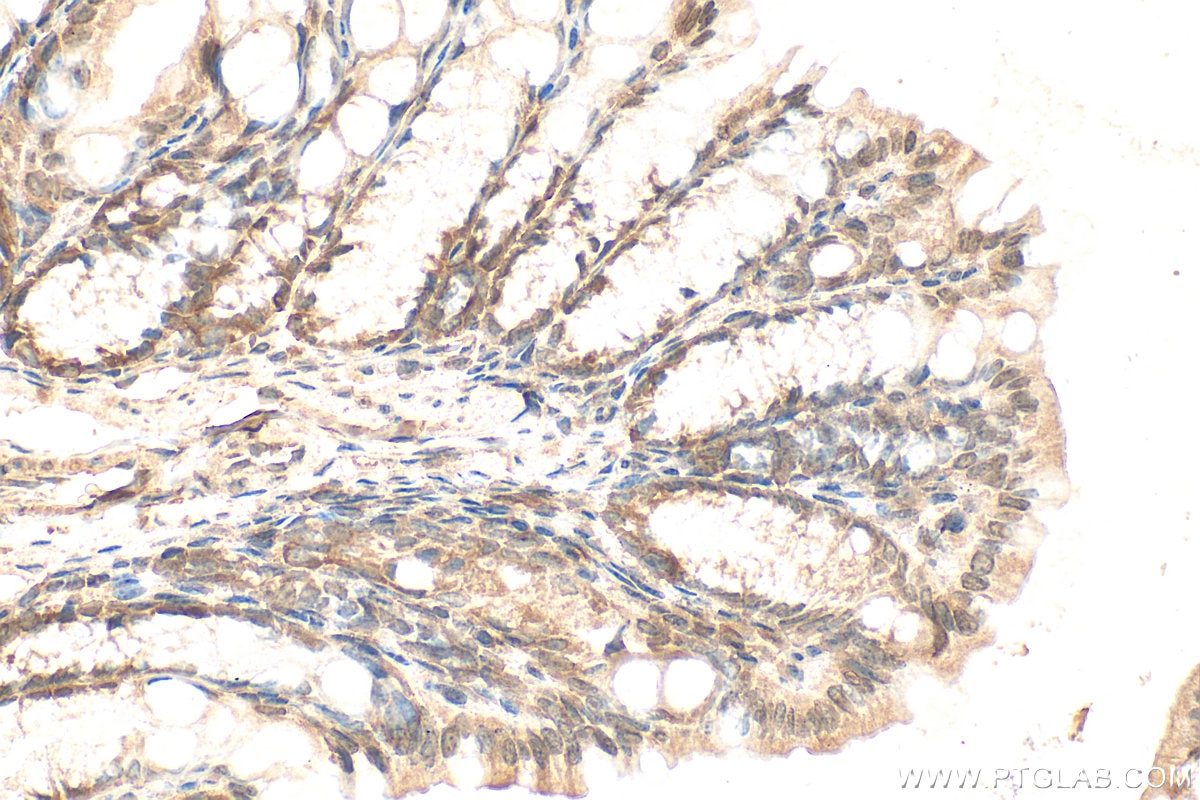 Immunohistochemistry (IHC) staining of mouse colon tissue using IFRD2 Polyclonal antibody (26952-1-AP)