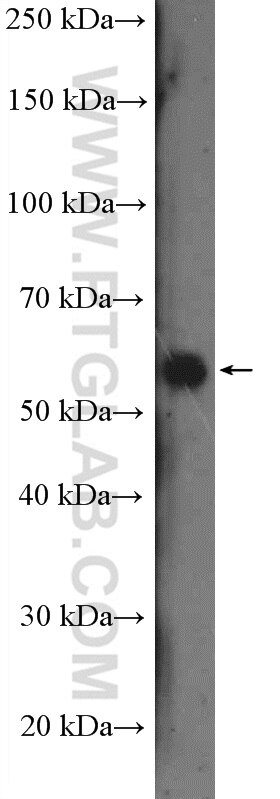 Western Blot (WB) analysis of HeLa cells using IFRD2 Polyclonal antibody (26952-1-AP)