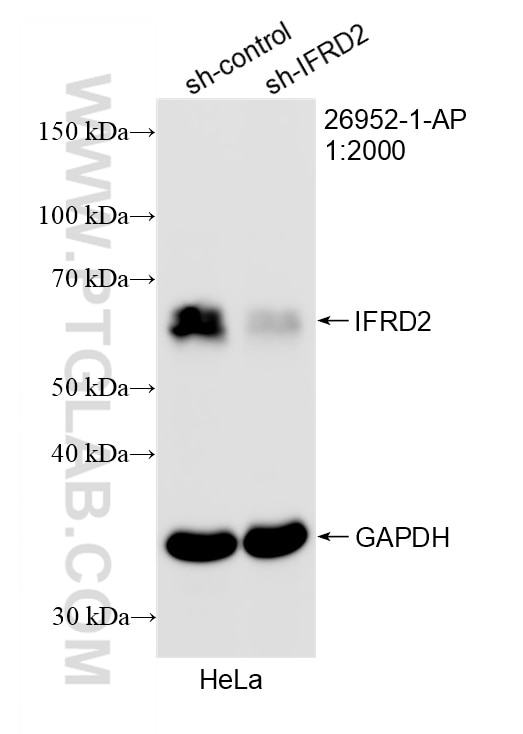 Western Blot (WB) analysis of HeLa cells using IFRD2 Polyclonal antibody (26952-1-AP)