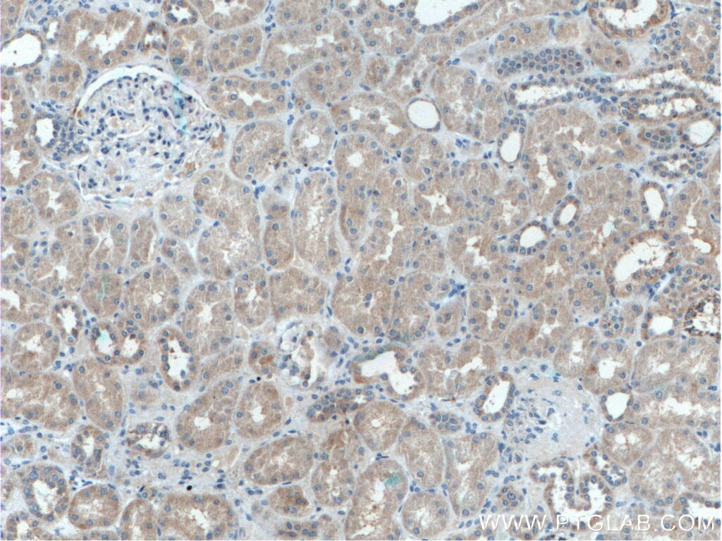 Immunohistochemistry (IHC) staining of human kidney tissue using IFRG15 Polyclonal antibody (21825-1-AP)