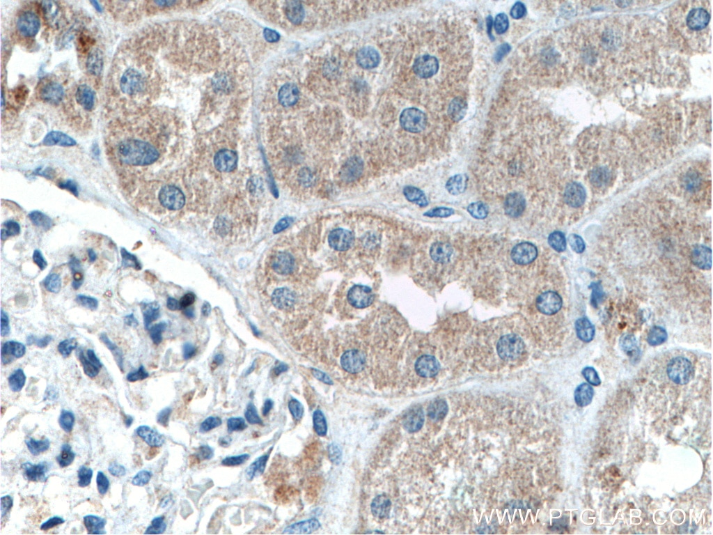 Immunohistochemistry (IHC) staining of human kidney tissue using IFRG15 Polyclonal antibody (21825-1-AP)