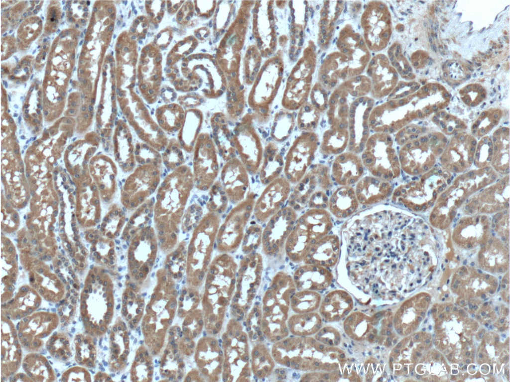 Immunohistochemistry (IHC) staining of human kidney tissue using IFRG15 Polyclonal antibody (21825-1-AP)