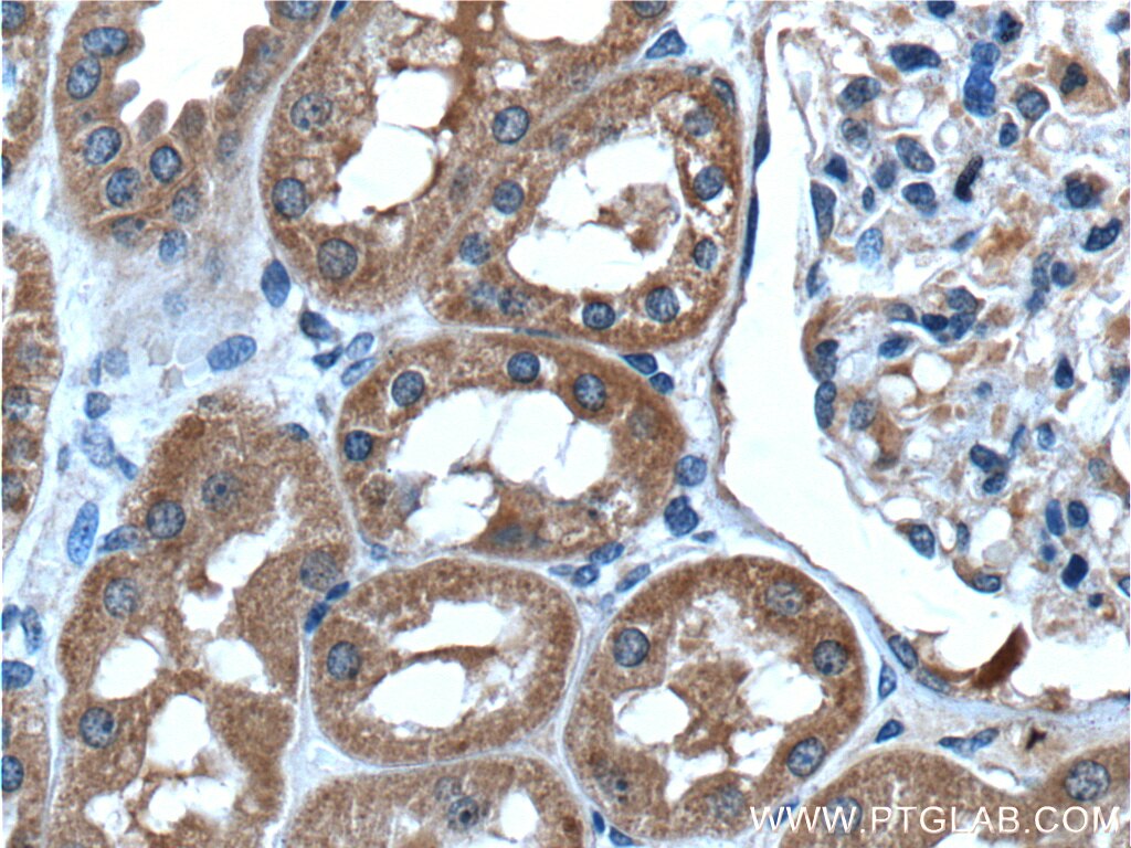 IHC staining of human kidney using 21825-1-AP