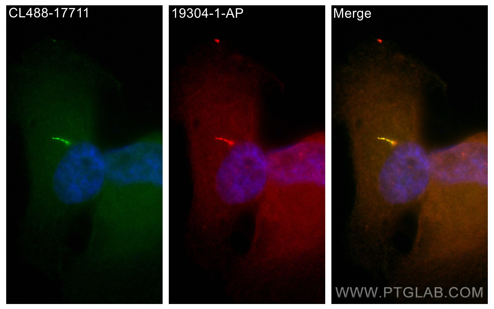 Immunofluorescence (IF) / fluorescent staining of hTERT-RPE1 cells using IFT122 Polyclonal antibody (19304-1-AP)