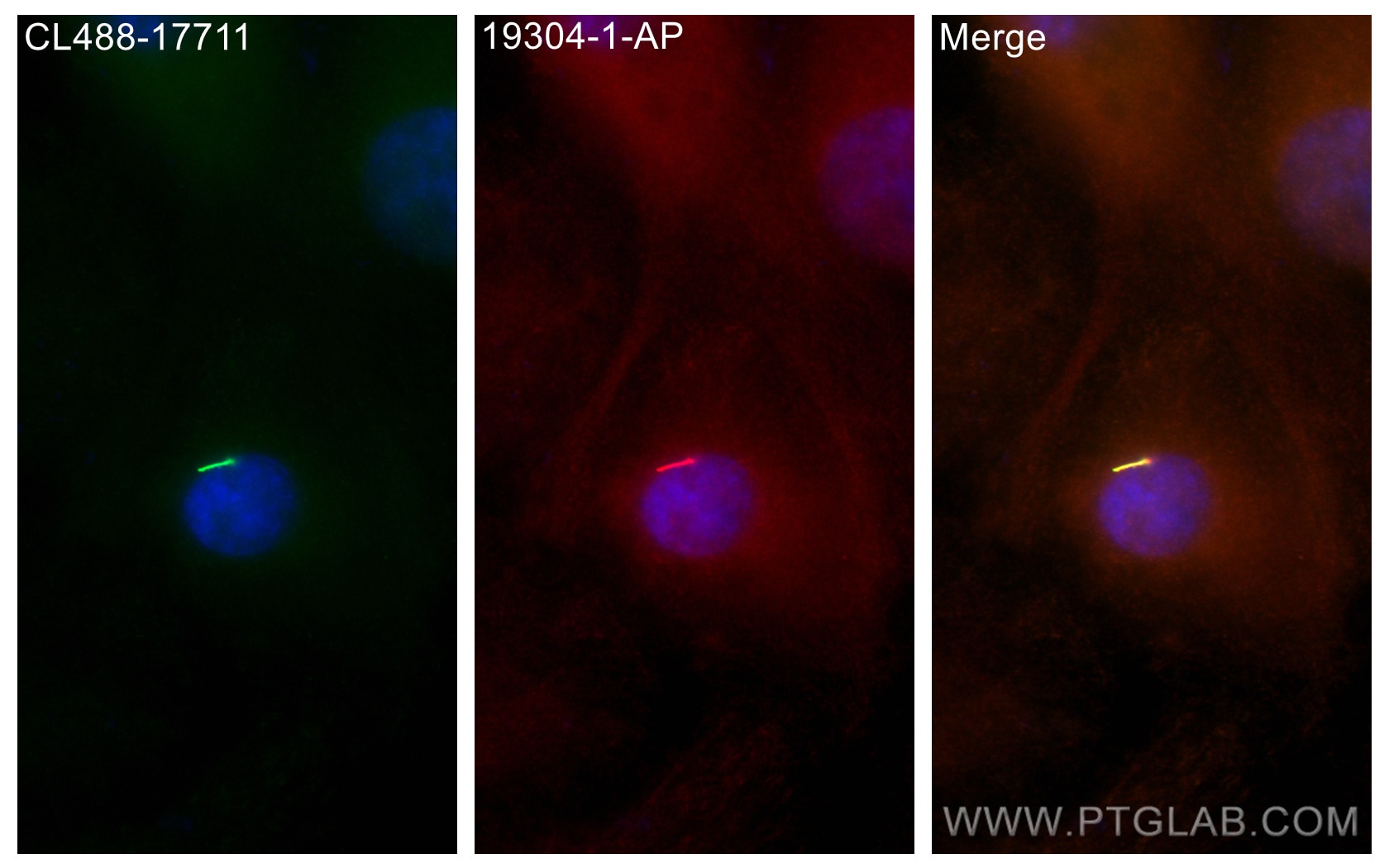 Immunofluorescence (IF) / fluorescent staining of hTERT-RPE1 cells using IFT122 Polyclonal antibody (19304-1-AP)