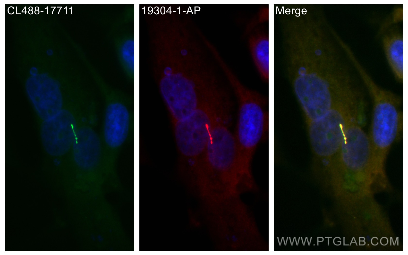 Immunofluorescence (IF) / fluorescent staining of MDCK cells using IFT122 Polyclonal antibody (19304-1-AP)