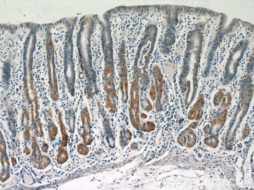 Immunohistochemistry (IHC) staining of human stomach tissue using IFT122 Polyclonal antibody (19304-1-AP)
