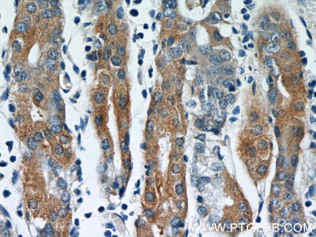 Immunohistochemistry (IHC) staining of human stomach tissue using IFT122 Polyclonal antibody (19304-1-AP)