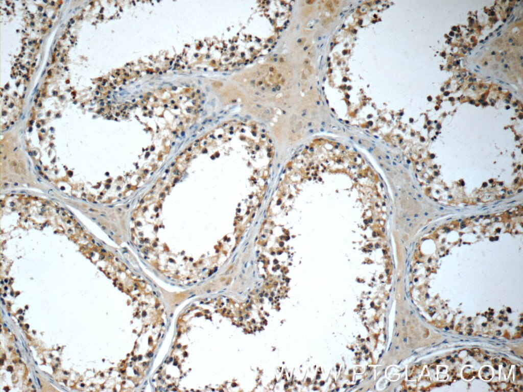 Immunohistochemistry (IHC) staining of human testis tissue using IFT122 Polyclonal antibody (19304-1-AP)