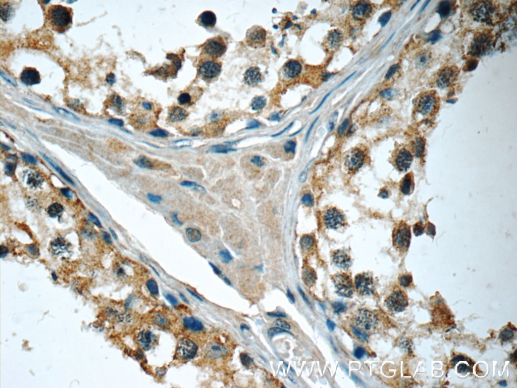 Immunohistochemistry (IHC) staining of human testis tissue using IFT122 Polyclonal antibody (19304-1-AP)