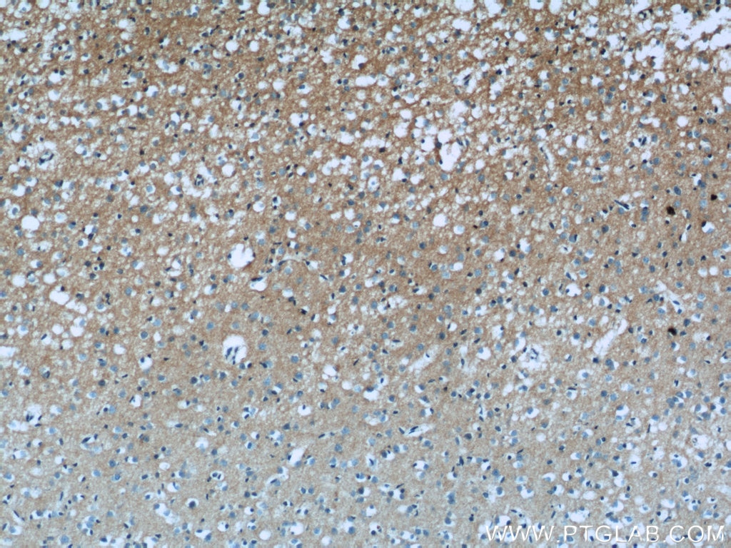 Immunohistochemistry (IHC) staining of human brain tissue using IFT122 Polyclonal antibody (19304-1-AP)