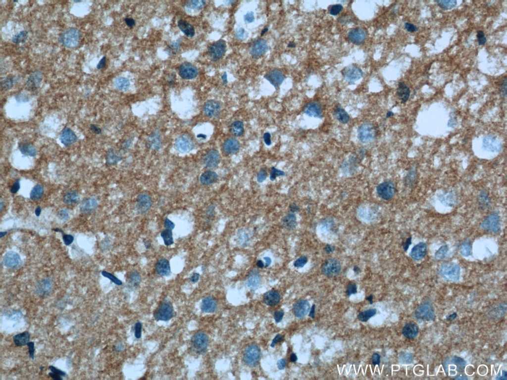 Immunohistochemistry (IHC) staining of human brain tissue using IFT122 Polyclonal antibody (19304-1-AP)