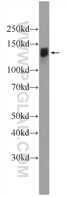 Western Blot (WB) analysis of mouse testis tissue using IFT122 Polyclonal antibody (19304-1-AP)