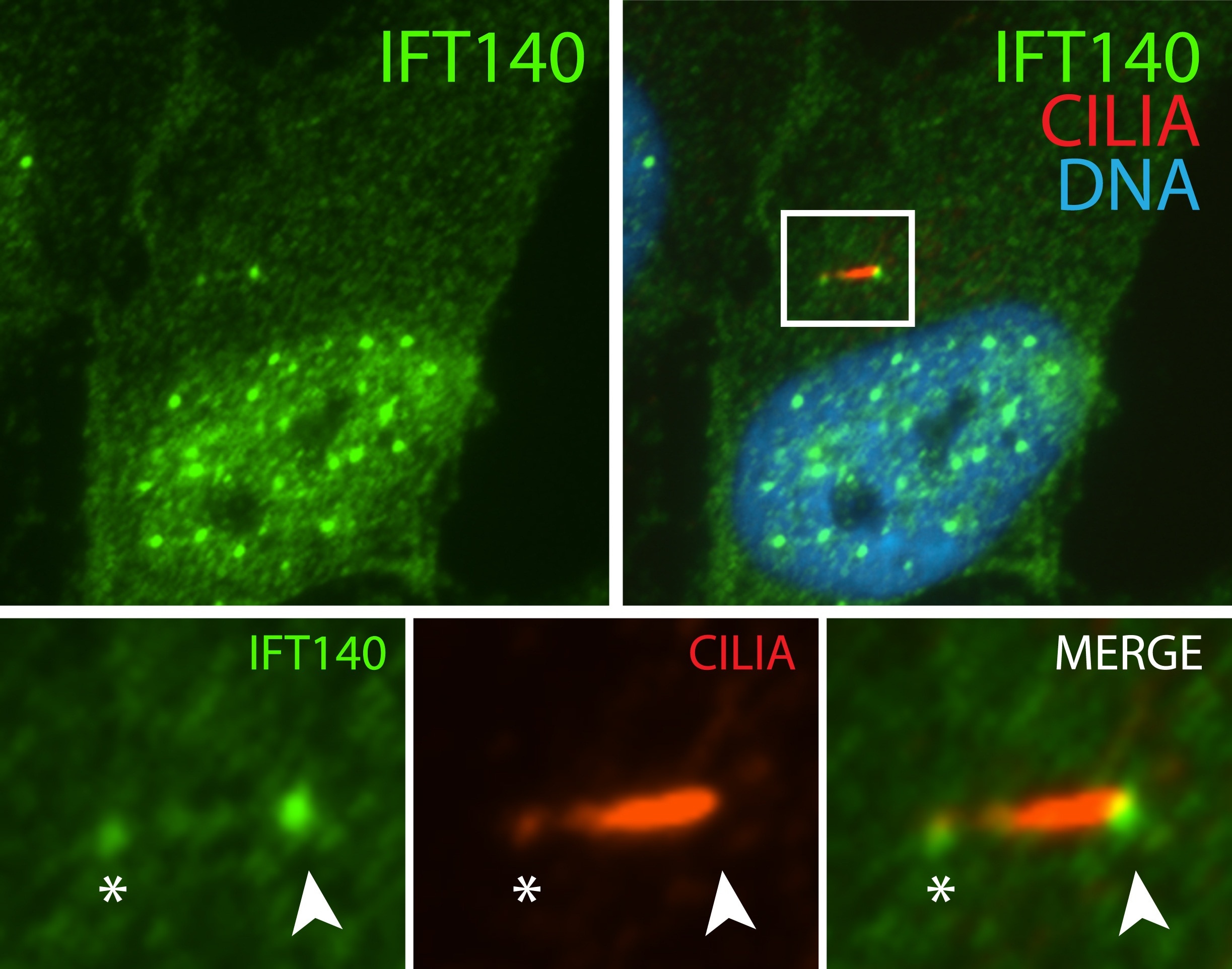 IFT140 Polyclonal antibody