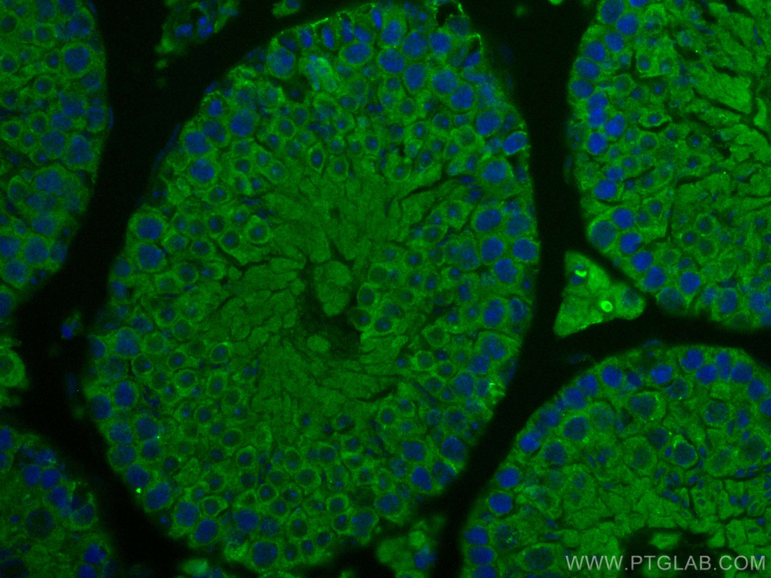 Immunofluorescence (IF) / fluorescent staining of mouse testis tissue using IFT140 Polyclonal antibody (17460-1-AP)