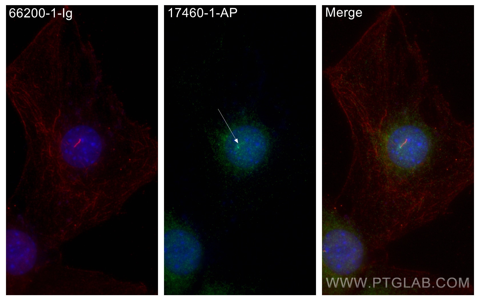 Immunofluorescence (IF) / fluorescent staining of C2C12 cells using IFT140 Polyclonal antibody (17460-1-AP)