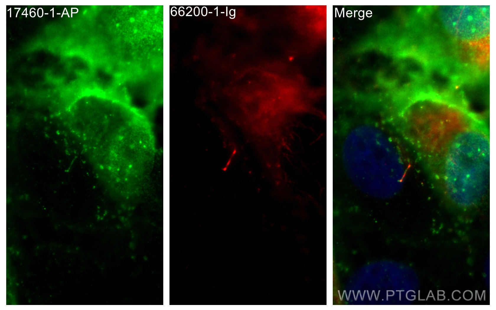 Immunofluorescence (IF) / fluorescent staining of hTERT-RPE1 cells using IFT140 Polyclonal antibody (17460-1-AP)