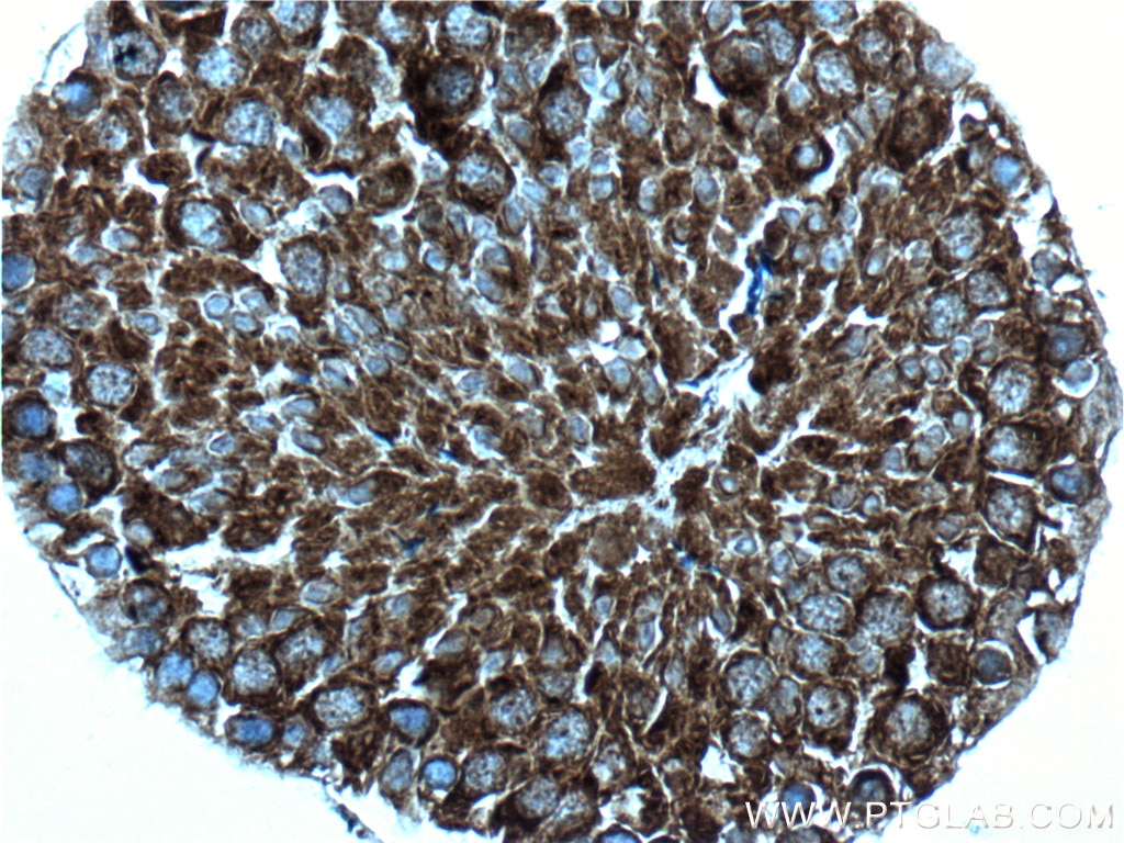 Immunohistochemistry (IHC) staining of mouse testis tissue using IFT140 Polyclonal antibody (17460-1-AP)