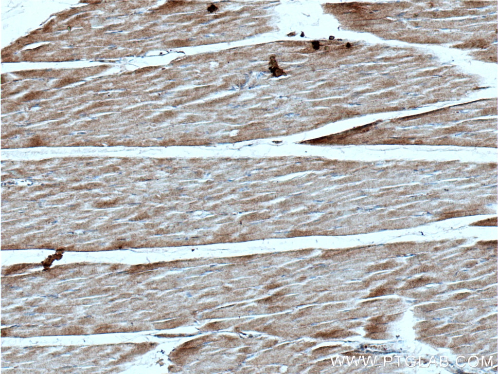 Immunohistochemistry (IHC) staining of human skeletal muscle tissue using IFT140 Polyclonal antibody (17460-1-AP)