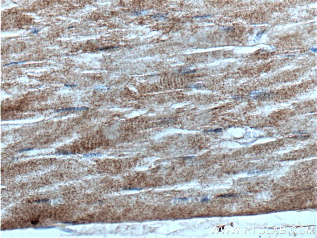 Immunohistochemistry (IHC) staining of human skeletal muscle tissue using IFT140 Polyclonal antibody (17460-1-AP)