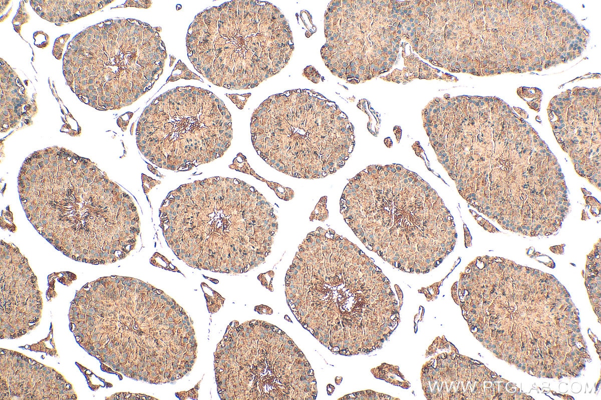 Immunohistochemistry (IHC) staining of mouse testis tissue using IFT140 Polyclonal antibody (17460-1-AP)