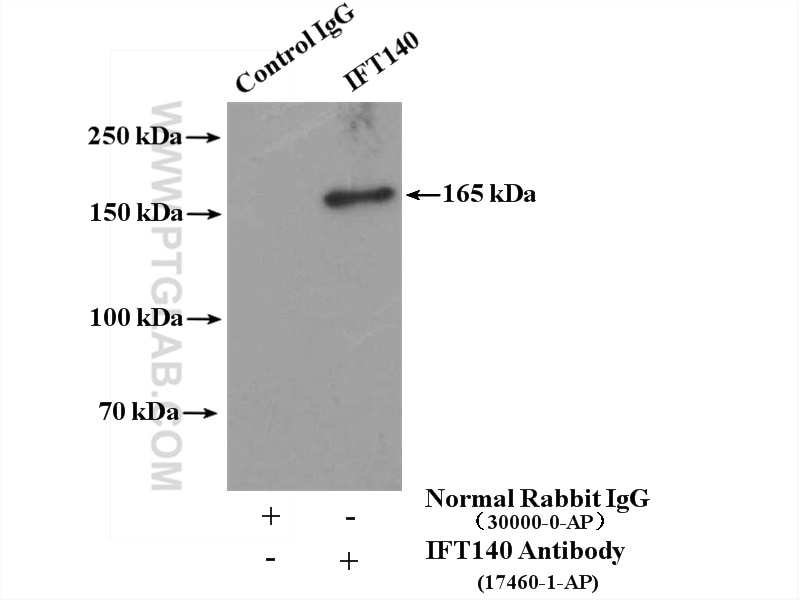 Immunoprecipitation (IP) experiment of rat testis tissue using IFT140 Polyclonal antibody (17460-1-AP)