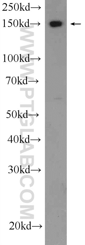 Western Blot (WB) analysis of mouse testis tissue using IFT140 Polyclonal antibody (17460-1-AP)