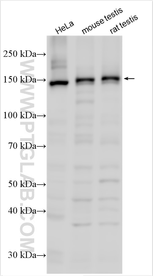 Western Blot (WB) analysis of various lysates using IFT140 Polyclonal antibody (17460-1-AP)