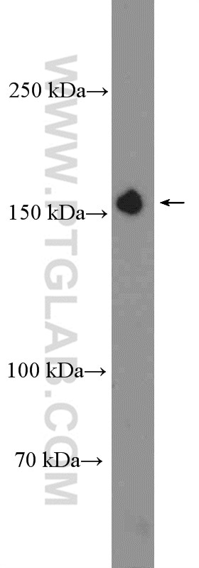 Western Blot (WB) analysis of rat testis tissue using IFT140 Polyclonal antibody (17460-1-AP)