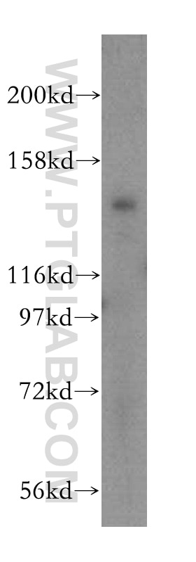 Western Blot (WB) analysis of HepG2 cells using IFT140 Polyclonal antibody (17460-1-AP)