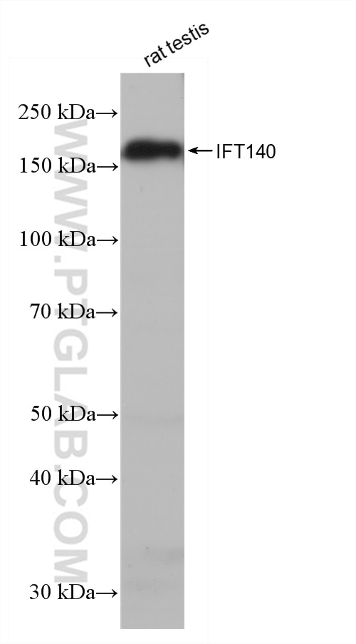 Western Blot (WB) analysis of rat testis tissue using IFT140 Recombinant antibody (82947-1-RR)