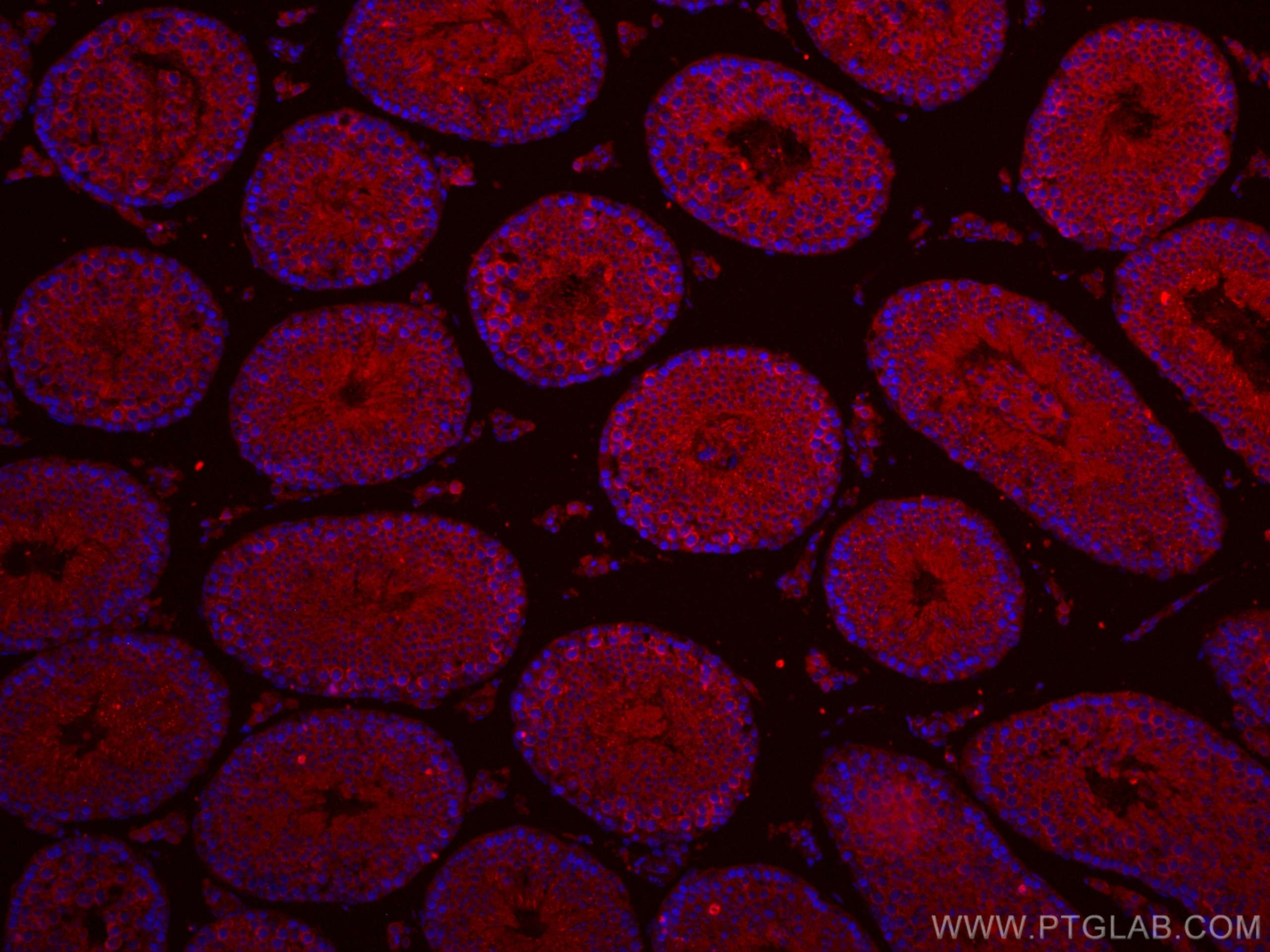 Immunofluorescence (IF) / fluorescent staining of mouse testis tissue using CoraLite®594-conjugated IFT140 Polyclonal antibody (CL594-17460)