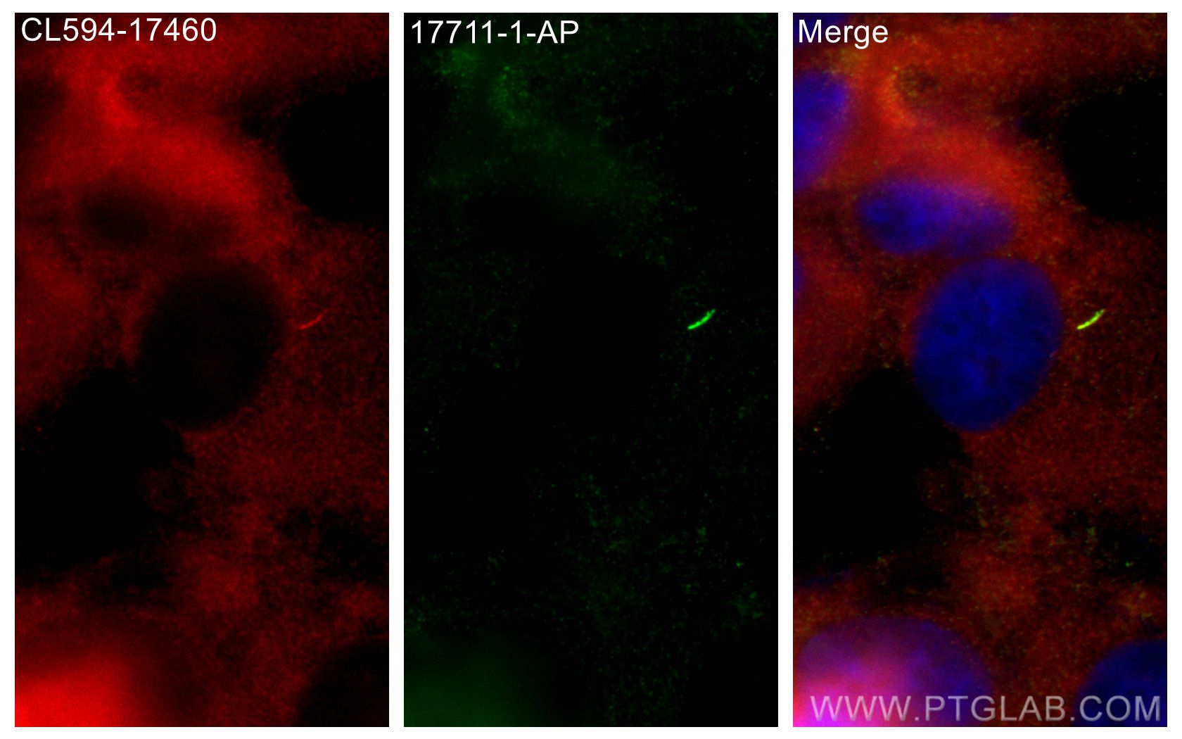 IF Staining of hTERT-RPE1 using CL594-17460