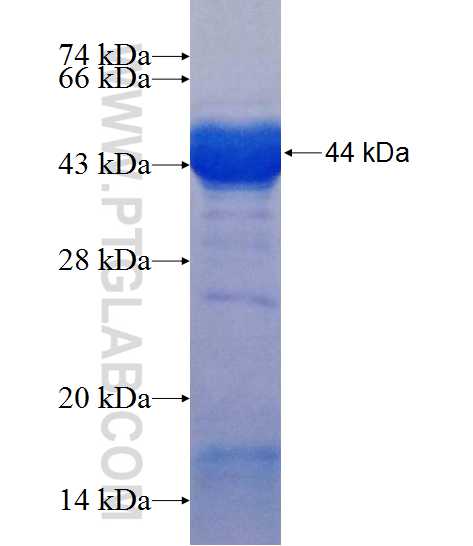 IFT140 fusion protein Ag11119 SDS-PAGE