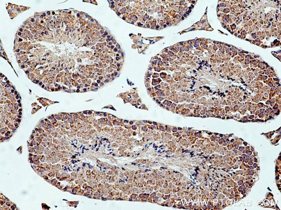 IHC staining of mouse testis using 28441-1-AP